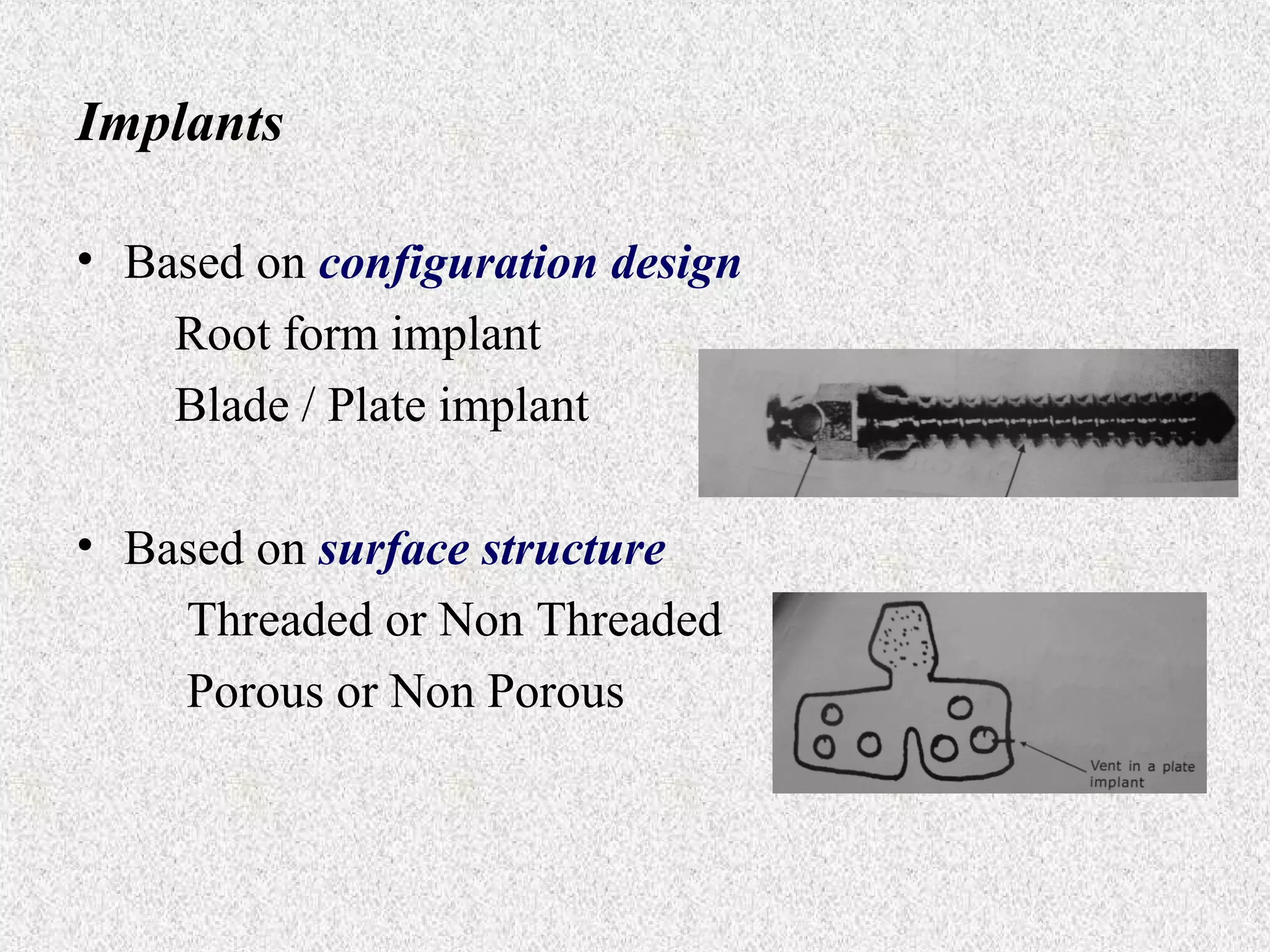 Implants
• Based on configuration design
Root form implant
Blade / Plate implant
• Based on surface structure
Threaded or Non Threaded
Porous or Non Porous

 