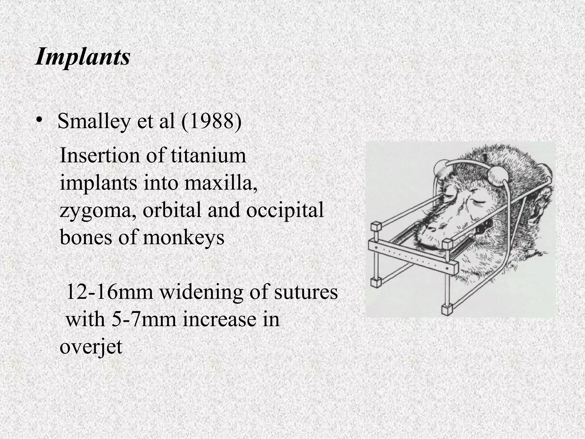 Implants
• Smalley et al (1988)
Insertion of titanium
implants into maxilla,
zygoma, orbital and occipital
bones of monkeys
12-16mm widening of sutures
with 5-7mm increase in
overjet

 