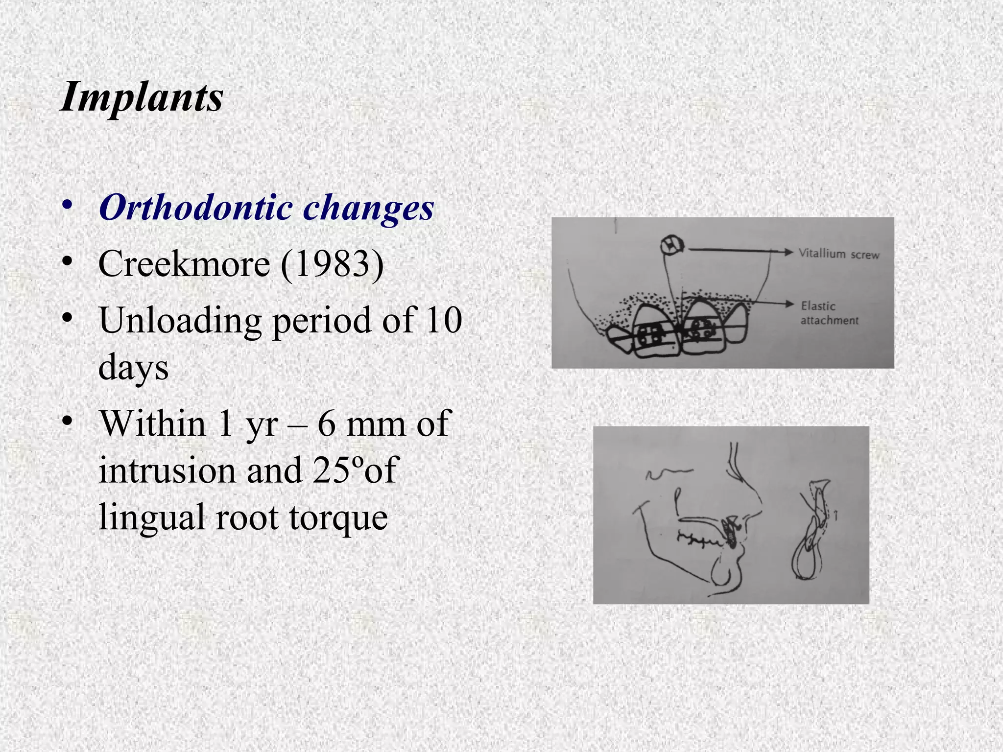 Implants
• Orthodontic changes
• Creekmore (1983)
• Unloading period of 10
days
• Within 1 yr – 6 mm of
intrusion and 25ºof
lingual root torque

 
