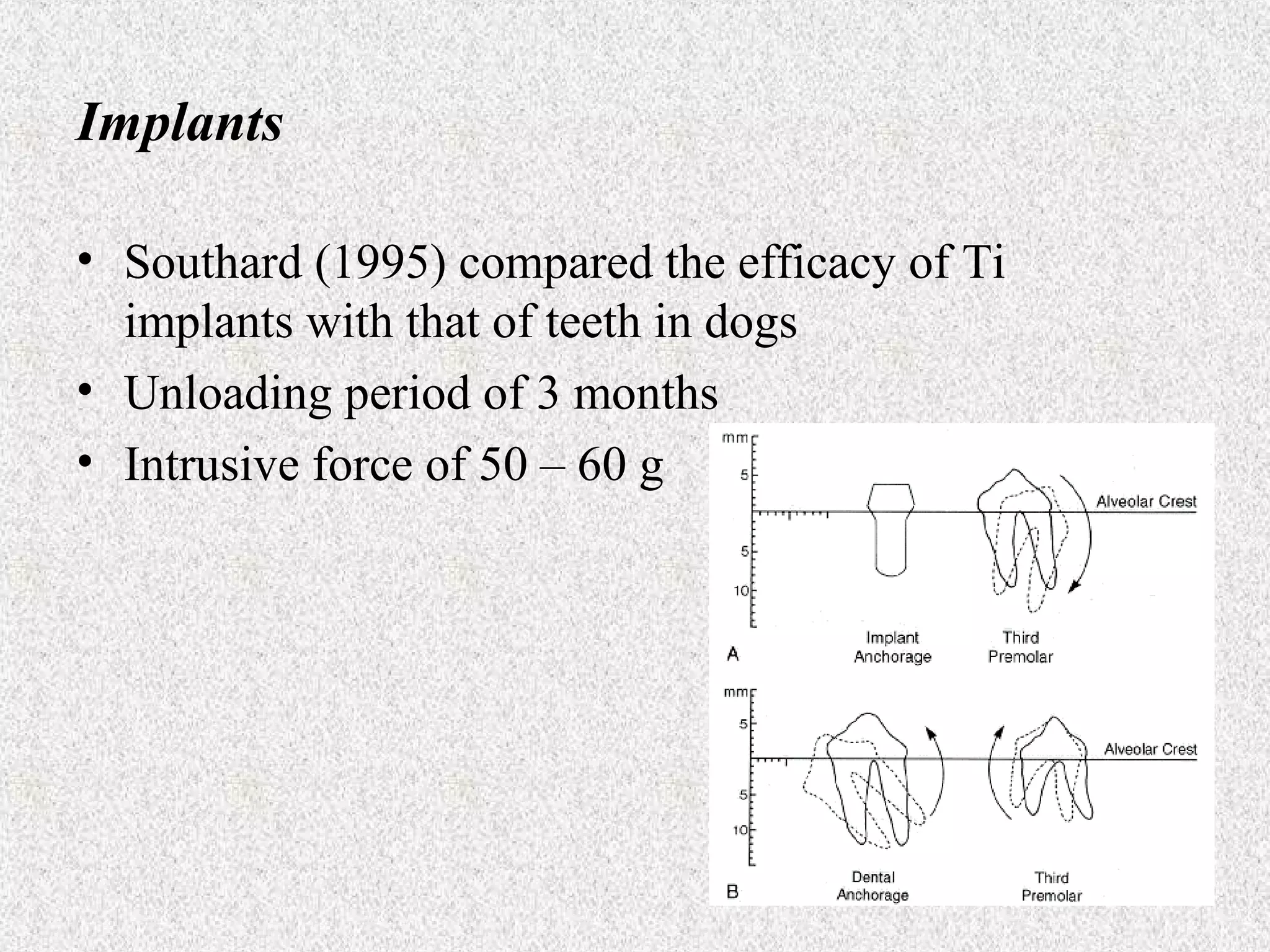 Implants
• Southard (1995) compared the efficacy of Ti
implants with that of teeth in dogs
• Unloading period of 3 months
• Intrusive force of 50 – 60 g

 