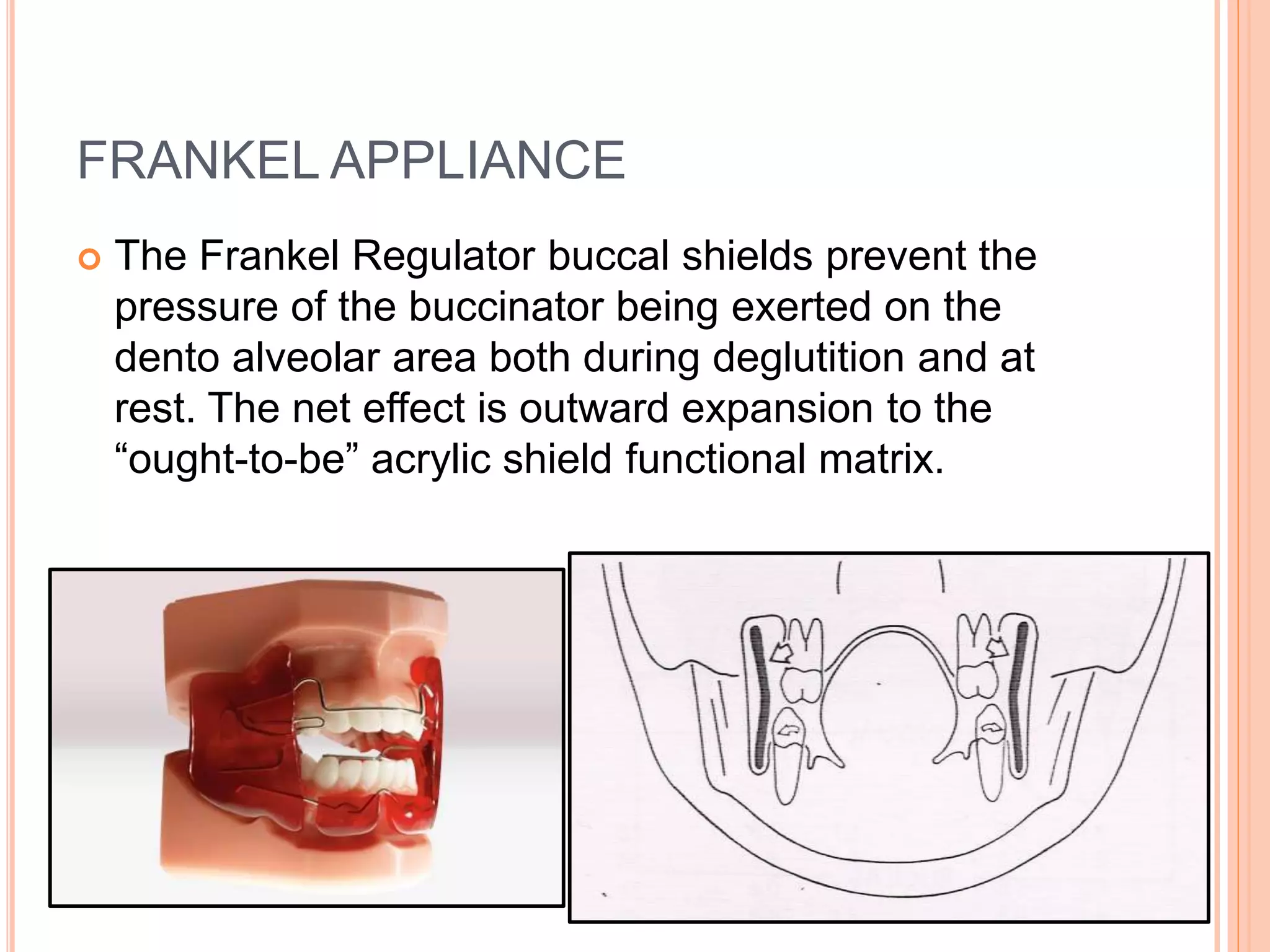 FRANKEL APPLIANCE
 The Frankel Regulator buccal shields prevent the
pressure of the buccinator being exerted on the
dento alveolar area both during deglutition and at
rest. The net effect is outward expansion to the
“ought-to-be” acrylic shield functional matrix.
 