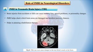 Role of Functional MRI in Neurological disorder | PDF