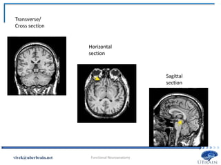 Vivek Misra
Transverse/
Cross section
Horizontal
section
Sagittal
section
 