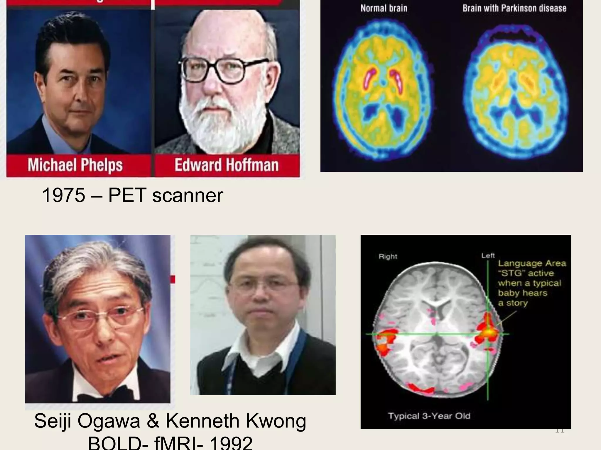 11
1975 – PET scanner
Seiji Ogawa & Kenneth Kwong
 