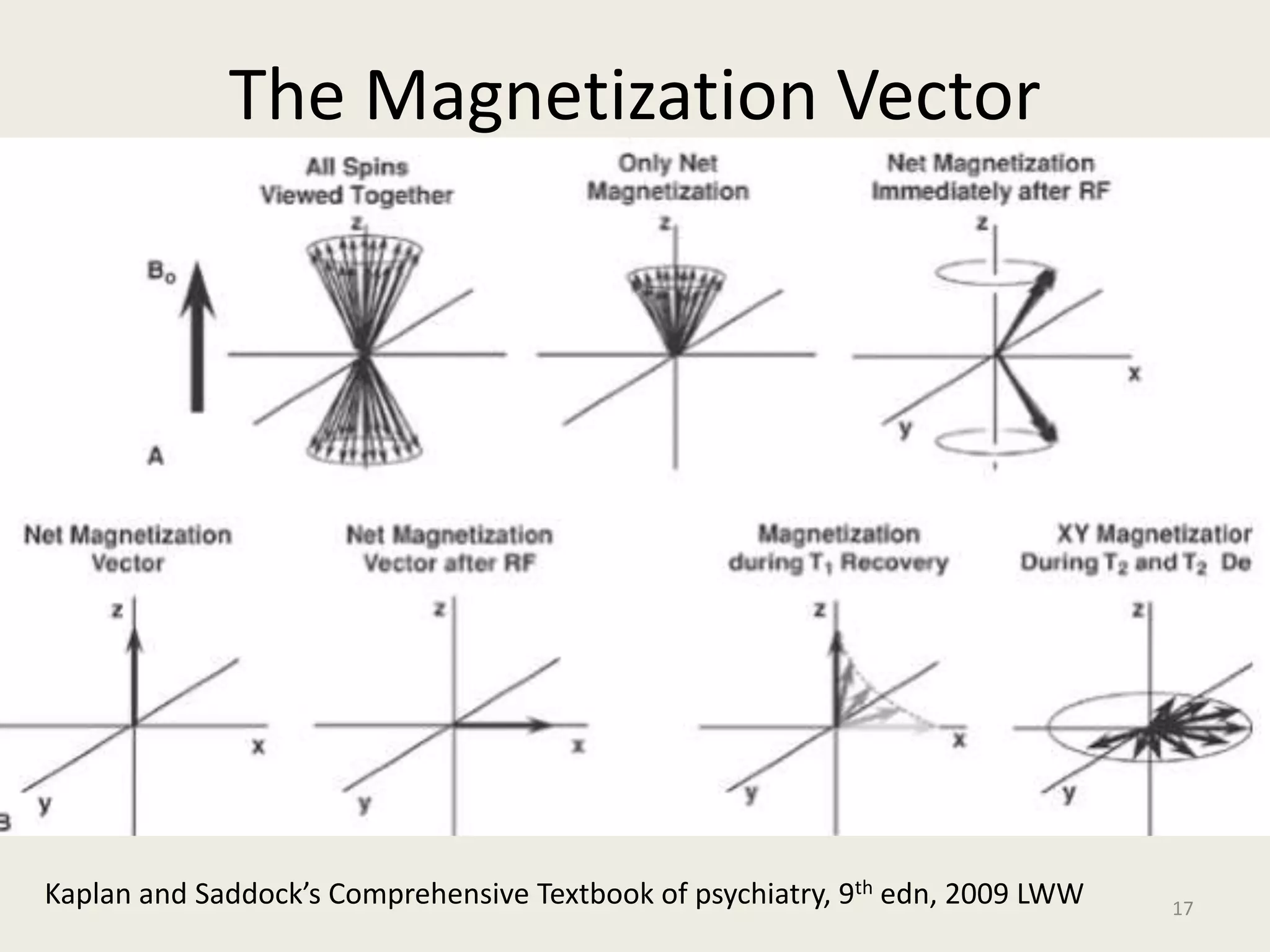 The Magnetization Vector
17
Kaplan and Saddock’s Comprehensive Textbook of psychiatry, 9th edn, 2009 LWW
 