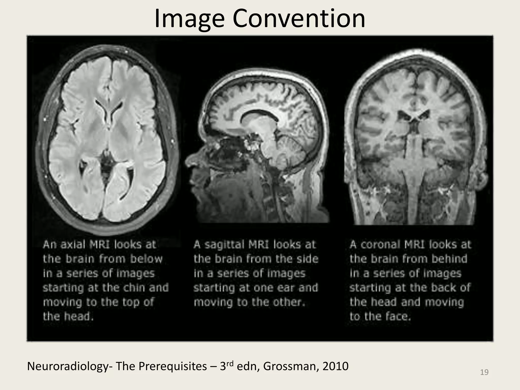 Image Convention
19
Neuroradiology- The Prerequisites – 3rd edn, Grossman, 2010
 