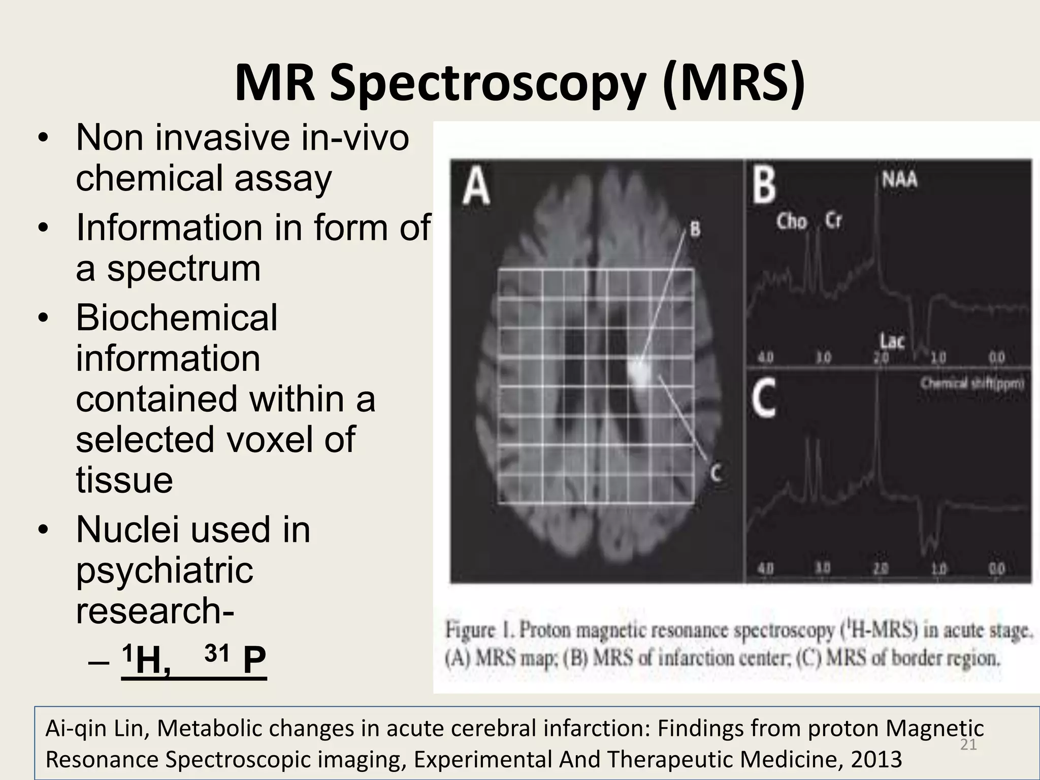 MR Spectroscopy (MRS)
• Non invasive in-vivo
chemical assay
• Information in form of
a spectrum
• Biochemical
information
contained within a
selected voxel of
tissue
• Nuclei used in
psychiatric
research-
– 1H, 31 P
21
Ai-qin Lin, Metabolic changes in acute cerebral infarction: Findings from proton Magnetic
Resonance Spectroscopic imaging, Experimental And Therapeutic Medicine, 2013
 