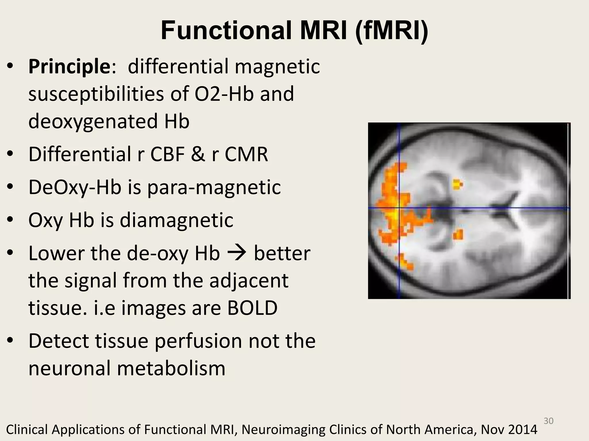 Functional MRI (fMRI)
• Principle: differential magnetic
susceptibilities of O2-Hb and
deoxygenated Hb
• Differential r CBF & r CMR
• DeOxy-Hb is para-magnetic
• Oxy Hb is diamagnetic
• Lower the de-oxy Hb  better
the signal from the adjacent
tissue. i.e images are BOLD
• Detect tissue perfusion not the
neuronal metabolism
30
Clinical Applications of Functional MRI, Neuroimaging Clinics of North America, Nov 2014
 