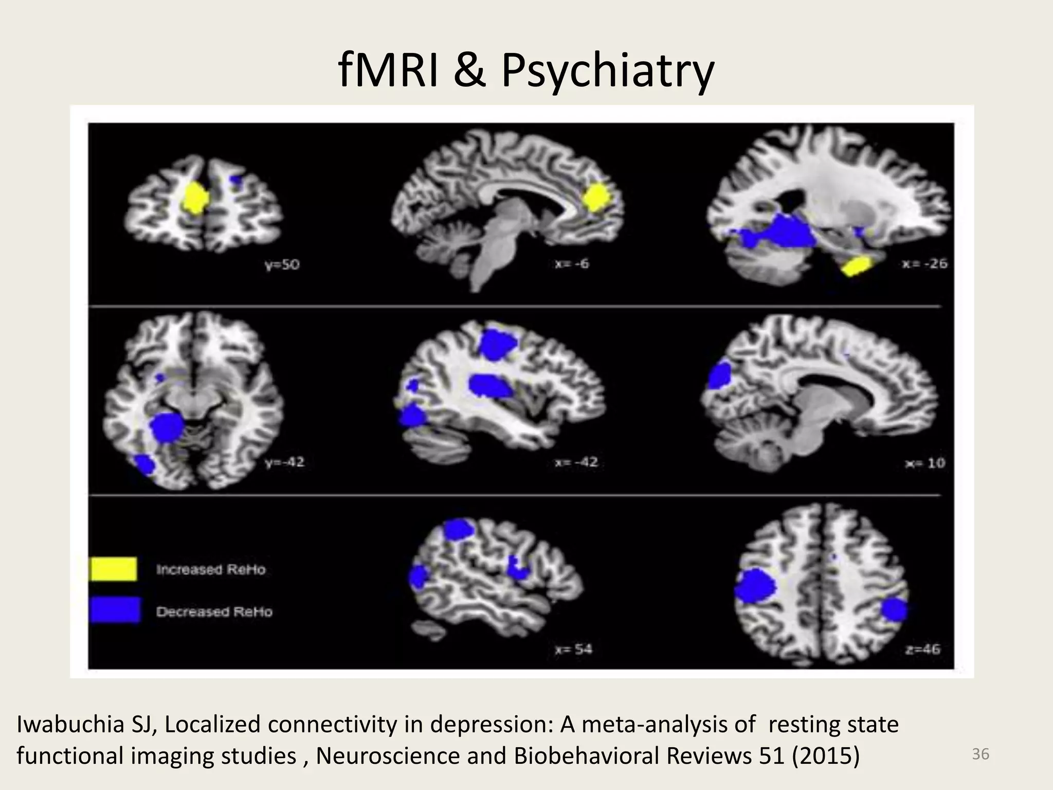 fMRI & Psychiatry
36
Iwabuchia SJ, Localized connectivity in depression: A meta-analysis of resting state
functional imaging studies , Neuroscience and Biobehavioral Reviews 51 (2015)
 