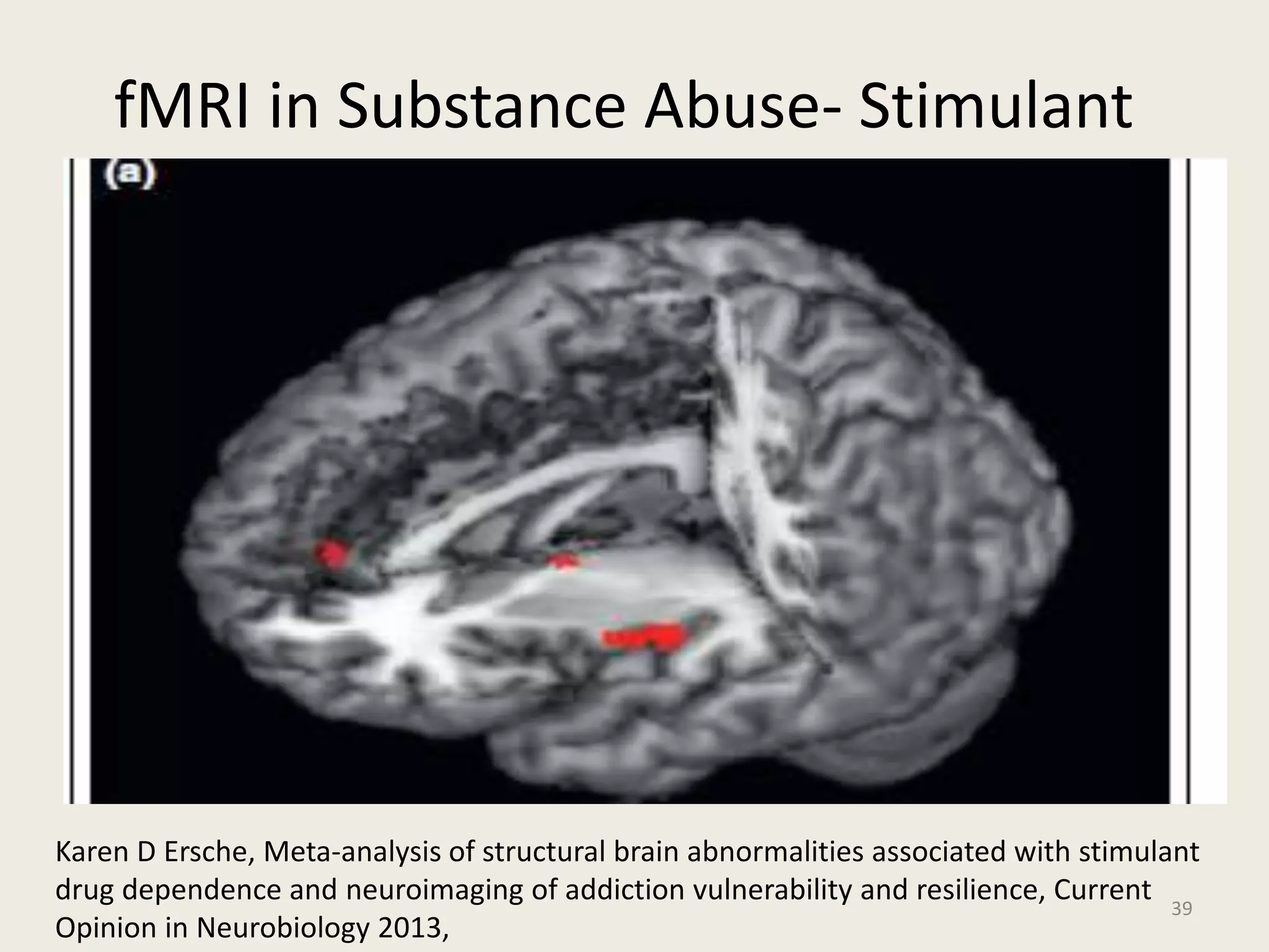 fMRI in Substance Abuse- Stimulant
– Compromised white matter integrity
– leading to functional impairments in decision
making.
39
Karen D Ersche, Meta-analysis of structural brain abnormalities associated with stimulant
drug dependence and neuroimaging of addiction vulnerability and resilience, Current
Opinion in Neurobiology 2013,
 
