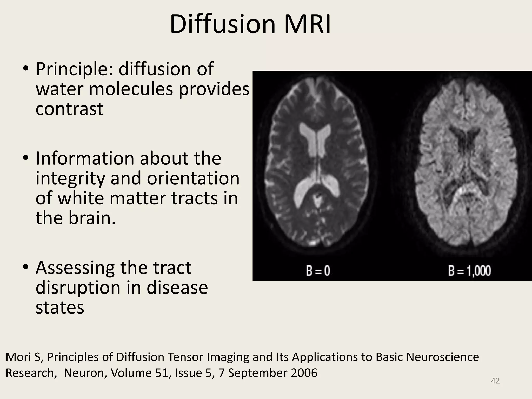 Diffusion MRI
• Principle: diffusion of
water molecules provides
contrast
• Information about the
integrity and orientation
of white matter tracts in
the brain.
• Assessing the tract
disruption in disease
states
42
Mori S, Principles of Diffusion Tensor Imaging and Its Applications to Basic Neuroscience
Research, Neuron, Volume 51, Issue 5, 7 September 2006
 
