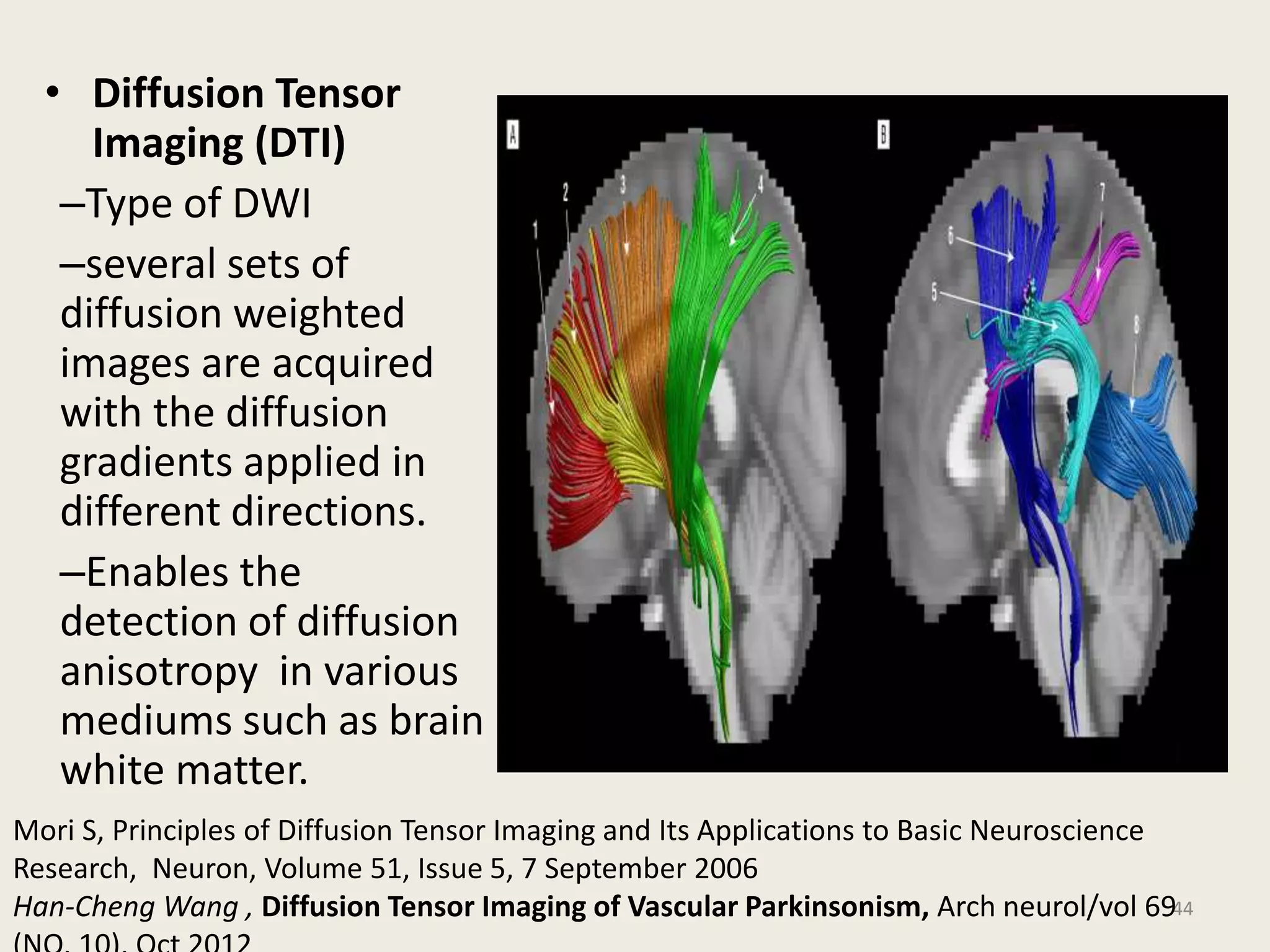 • Diffusion Tensor
Imaging (DTI)
–Type of DWI
–several sets of
diffusion weighted
images are acquired
with the diffusion
gradients applied in
different directions.
–Enables the
detection of diffusion
anisotropy in various
mediums such as brain
white matter.
44
Mori S, Principles of Diffusion Tensor Imaging and Its Applications to Basic Neuroscience
Research, Neuron, Volume 51, Issue 5, 7 September 2006
Han-Cheng Wang , Diffusion Tensor Imaging of Vascular Parkinsonism, Arch neurol/vol 69
 