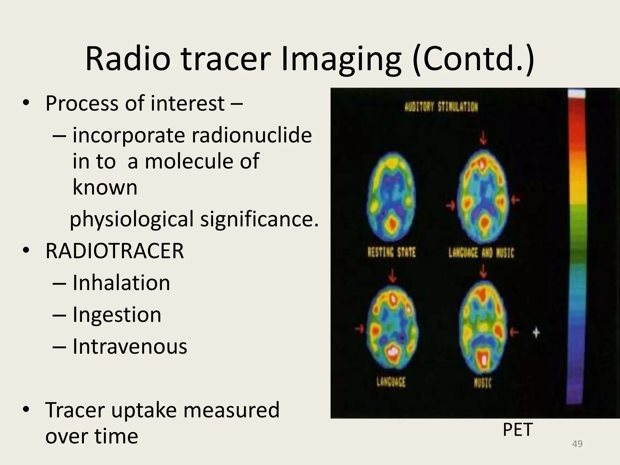 Radio tracer Imaging (Contd.)
• Process of interest –
– incorporate radionuclide
in to a molecule of
known
physiological significance.
• RADIOTRACER
– Inhalation
– Ingestion
– Intravenous
• Tracer uptake measured
over time PET
49
 