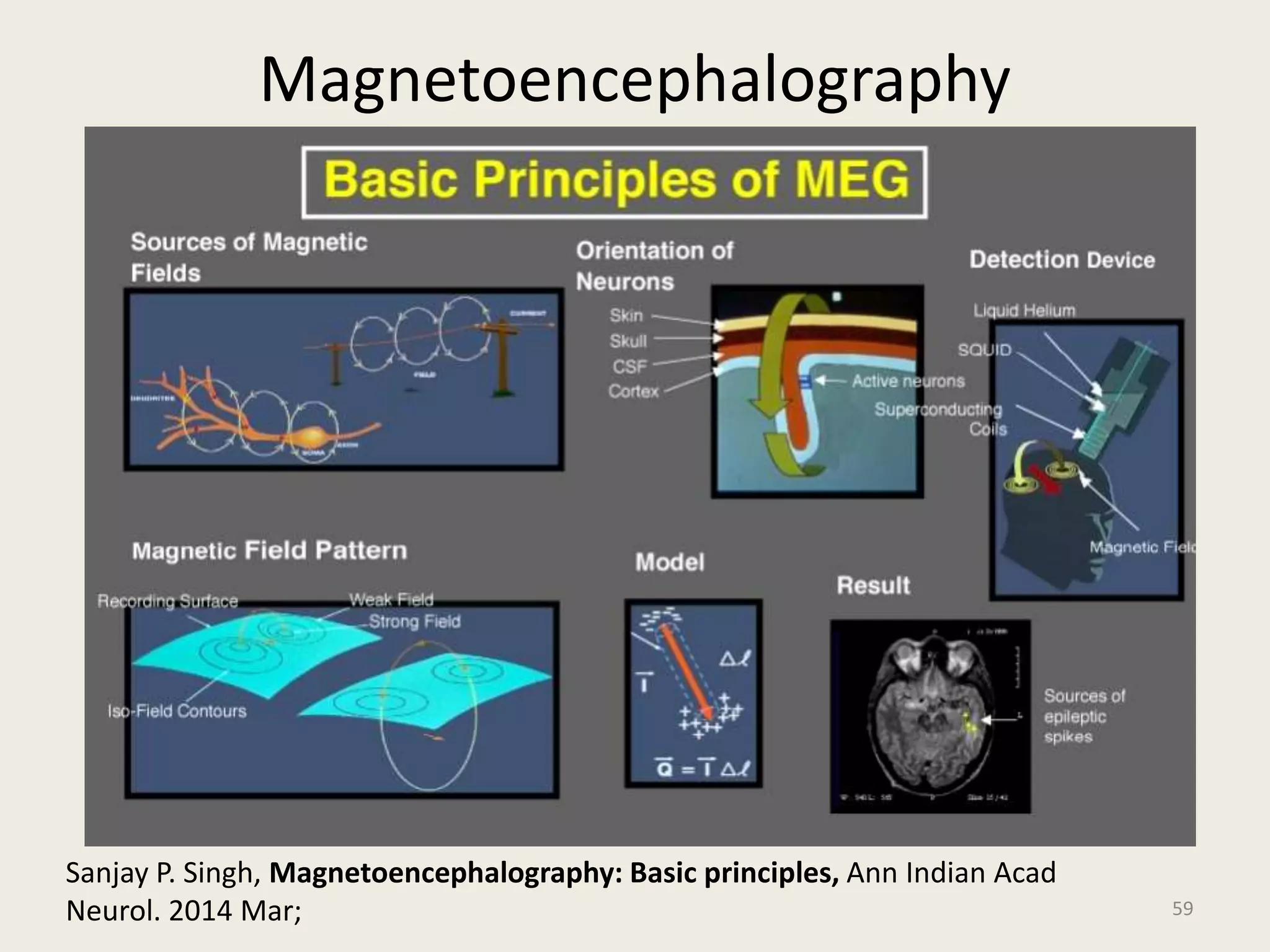 Magnetoencephalography
59
Sanjay P. Singh, Magnetoencephalography: Basic principles, Ann Indian Acad
Neurol. 2014 Mar;
 