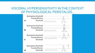 VISCERAL HYPERSENSITIVITY INTHE CONTEXT
OF PHYSIOLOGICAL PERISTALSIS..
 