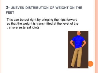 3- UNEVEN DISTRIBUTION OF WEIGHT ON THE
FEET
This can be put right by bringing the hips forward
so that the weight is transmitted at the level of the
transverse tarsal joints
 