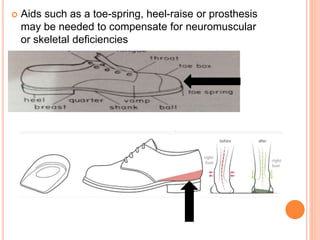  Aids such as a toe-spring, heel-raise or prosthesis
may be needed to compensate for neuromuscular
or skeletal deficiencies
 