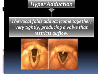 Functional voice disorder andd managementpresentation. | PPT