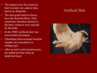 Artificial Skin
• The typical cover for extensive
burn wounds was cadaver skin,
known as allografts.
• The skin grafts did not always
have the desired effects. They
sometimes introduce disease to
the burn victim or were rejected
by the body.
• In the 1980’s artificial skin was
successfully developed.
• Fibroblasts from neonatal foreskin
samples are enmeshed in a
collagen gel.
• After several weeks keratinocytes
are added and they form an
epidermal layer.
 