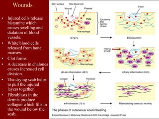 Wounds
• Injured cells release
histamine which
causes swelling and
dialation of blood
vessels.
• White blood cells
released from bone
marrow.
• Clot forms
• A decrease in chalones
causes increased cell
division.
• The drying scab helps
to pull the injured
layers together.
• Fibroblasts in the
dermis produce
collagen which fills in
the wound below the
scab.
 