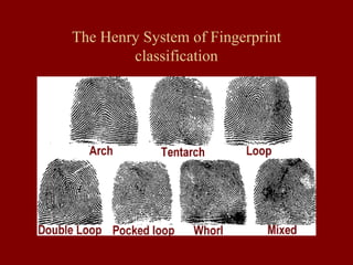 The Henry System of Fingerprint
classification
 