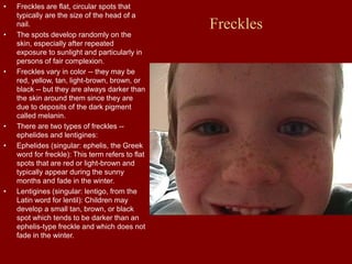 Freckles
• Freckles are flat, circular spots that
typically are the size of the head of a
nail.
• The spots develop randomly on the
skin, especially after repeated
exposure to sunlight and particularly in
persons of fair complexion.
• Freckles vary in color -- they may be
red, yellow, tan, light-brown, brown, or
black -- but they are always darker than
the skin around them since they are
due to deposits of the dark pigment
called melanin.
• There are two types of freckles --
ephelides and lentigines:
• Ephelides (singular: ephelis, the Greek
word for freckle): This term refers to flat
spots that are red or light-brown and
typically appear during the sunny
months and fade in the winter.
• Lentigines (singular: lentigo, from the
Latin word for lentil): Children may
develop a small tan, brown, or black
spot which tends to be darker than an
ephelis-type freckle and which does not
fade in the winter.
 