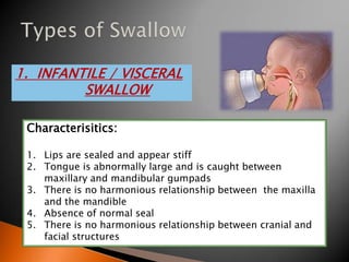 1. INFANTILE / VISCERAL
SWALLOW
Characterisitics:
1. Lips are sealed and appear stiff
2. Tongue is abnormally large and is caught between
maxillary and mandibular gumpads
3. There is no harmonious relationship between the maxilla
and the mandible
4. Absence of normal seal
5. There is no harmonious relationship between cranial and
facial structures
 