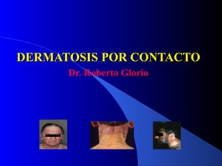 DERMATOSIS POR CONTACTO
      Dr. Roberto Glorio
 