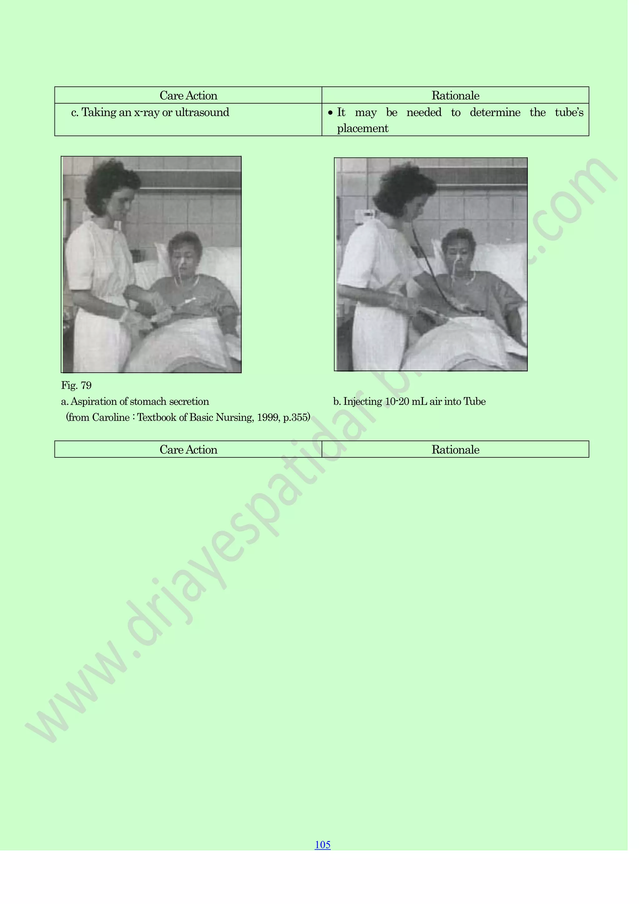 105
105
105
CareAction Rationale
c. Taking an x-ray or ultrasound It may be needed to determine the tube‟s
placement
Fig. 79
a.Aspiration of stomach secretion b. Injecting 10-20 mL air into Tube
(from Caroline : Textbook of Basic Nursing, 1999, p.355)
CareAction Rationale
 