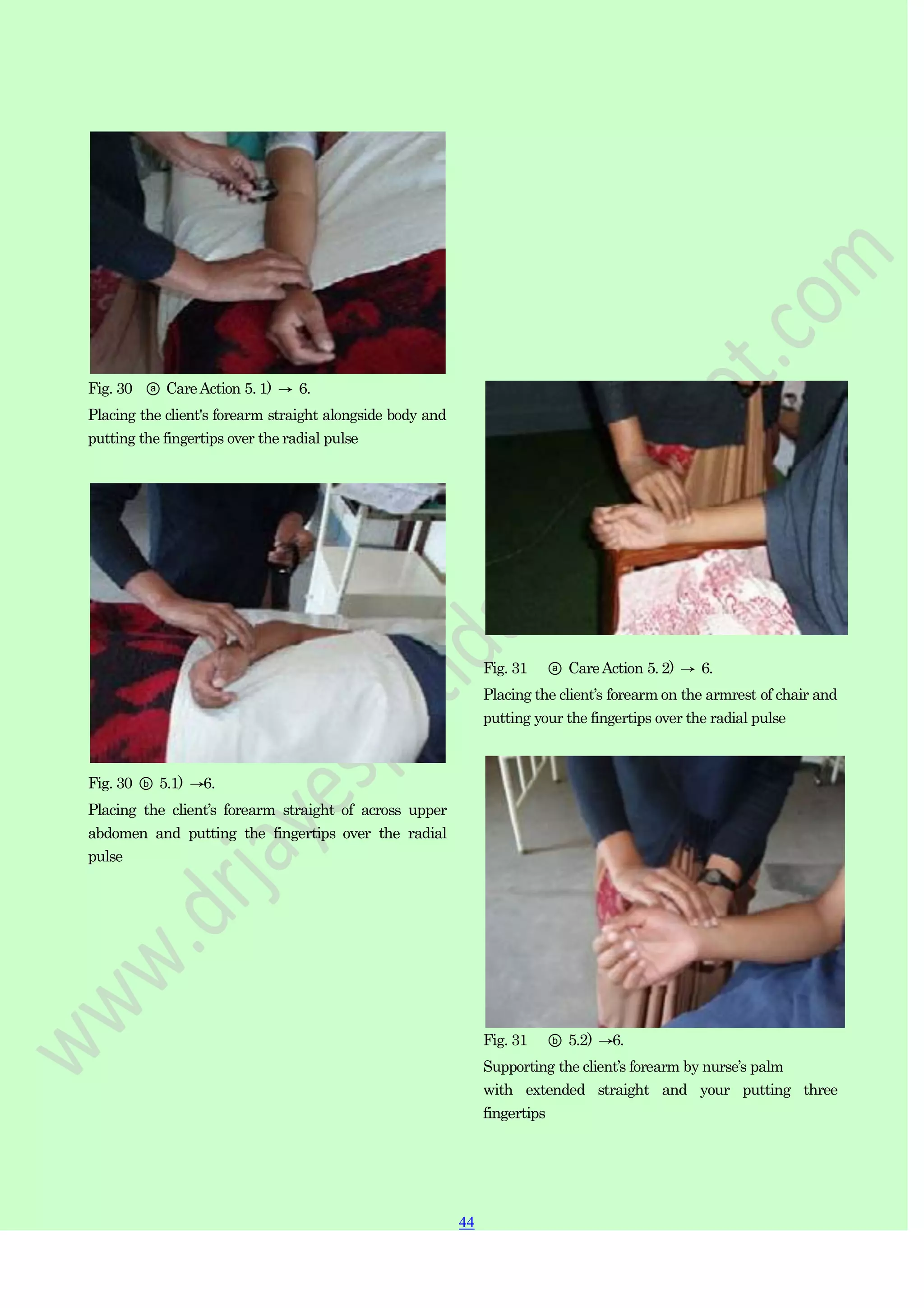 44
44
Fig. 30 ⓐ CareAction 5. 1) → 6.
Placing the client's forearm straight alongside body and
putting the fingertips over the radial pulse
Fig. 30 ⓑ 5.1) →6.
Placing the client‟s forearm straight of across upper
abdomen and putting the fingertips over the radial
pulse
Fig. 31 ⓐ CareAction 5. 2) → 6.
Placing the client‟s forearm on the armrest of chair and
putting your the fingertips over the radial pulse
Fig. 31 ⓑ 5.2) →6.
Supporting the client‟s forearm by nurse‟s palm
with extended straight and your putting three
fingertips
 
