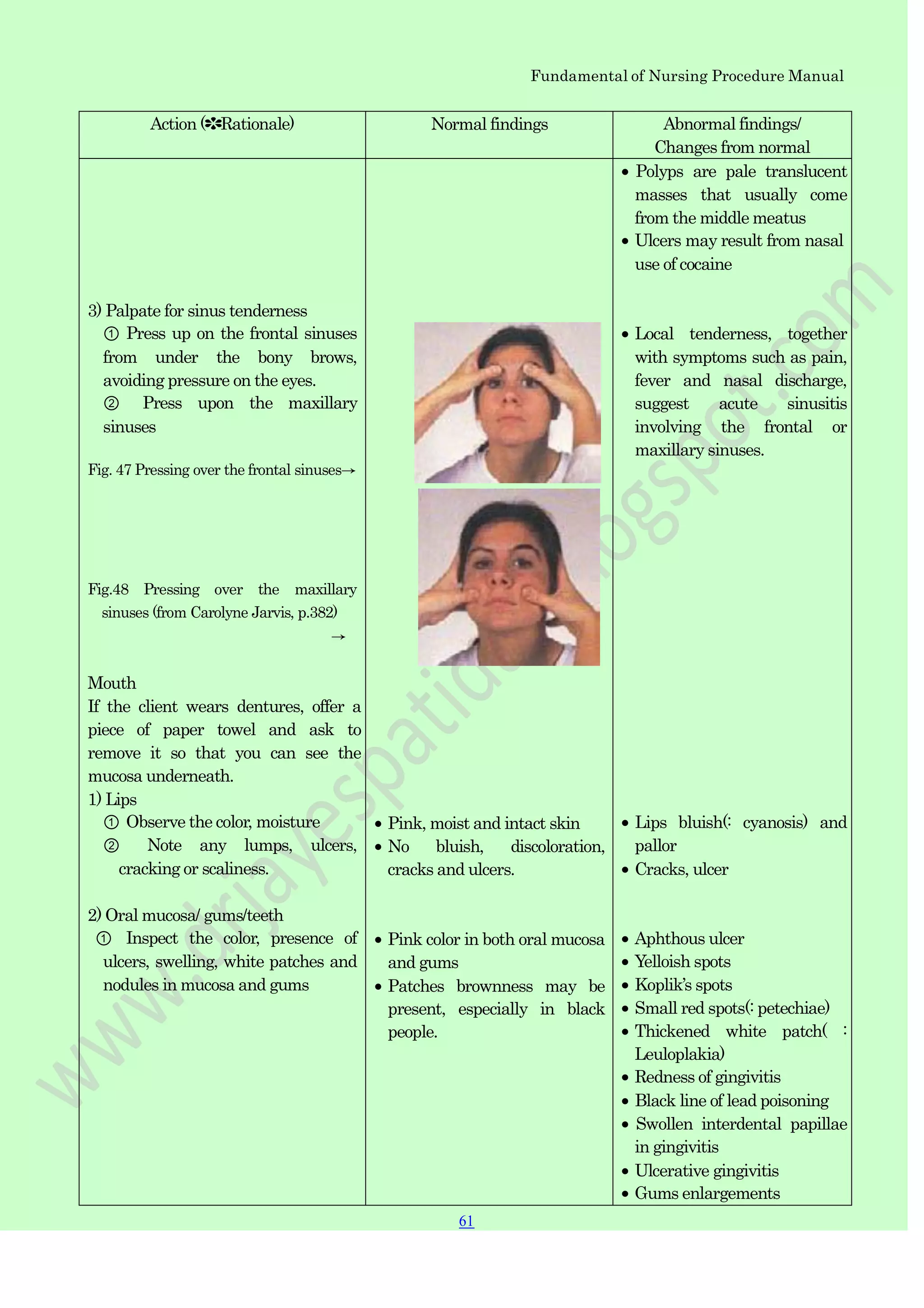 Fundamental of Nursing Procedure Manual
Action (✽Rationale) Normal findings Abnormal findings/
Changes from normal
3) Palpate for sinus tenderness
① Press up on the frontal sinuses
from under the bony brows,
avoiding pressure on the eyes.
② Press upon the maxillary
sinuses
Fig. 47 Pressing over the frontal sinuses→
Fig.48 Pressing over the maxillary
sinuses (from Carolyne Jarvis, p.382)
→
Mouth
If the client wears dentures, offer a
piece of paper towel and ask to
remove it so that you can see the
mucosa underneath.
1) Lips
① Observe the color, moisture
② Note any lumps, ulcers,
cracking or scaliness.
2) Oral mucosa/ gums/teeth
① Inspect the color, presence of
ulcers, swelling, white patches and
nodules in mucosa and gums
Pink, moist and intact skin
No bluish, discoloration,
cracks and ulcers.
Pink color in both oral mucosa
and gums
Patches brownness may be
present, especially in black
people.
Polyps are pale translucent
masses that usually come
from the middle meatus
Ulcers may result from nasal
use of cocaine
Local tenderness, together
with symptoms such as pain,
fever and nasal discharge,
suggest acute sinusitis
involving the frontal or
maxillary sinuses.
Lips bluish(: cyanosis) and
pallor
Cracks, ulcer
Aphthous ulcer
Yelloish spots
Koplik‟s spots
Small red spots(: petechiae)
Thickened white patch( :
Leuloplakia)
Redness of gingivitis
Black line of lead poisoning
Swollen interdental papillae
in gingivitis
Ulcerative gingivitis
Gums enlargements
61
 