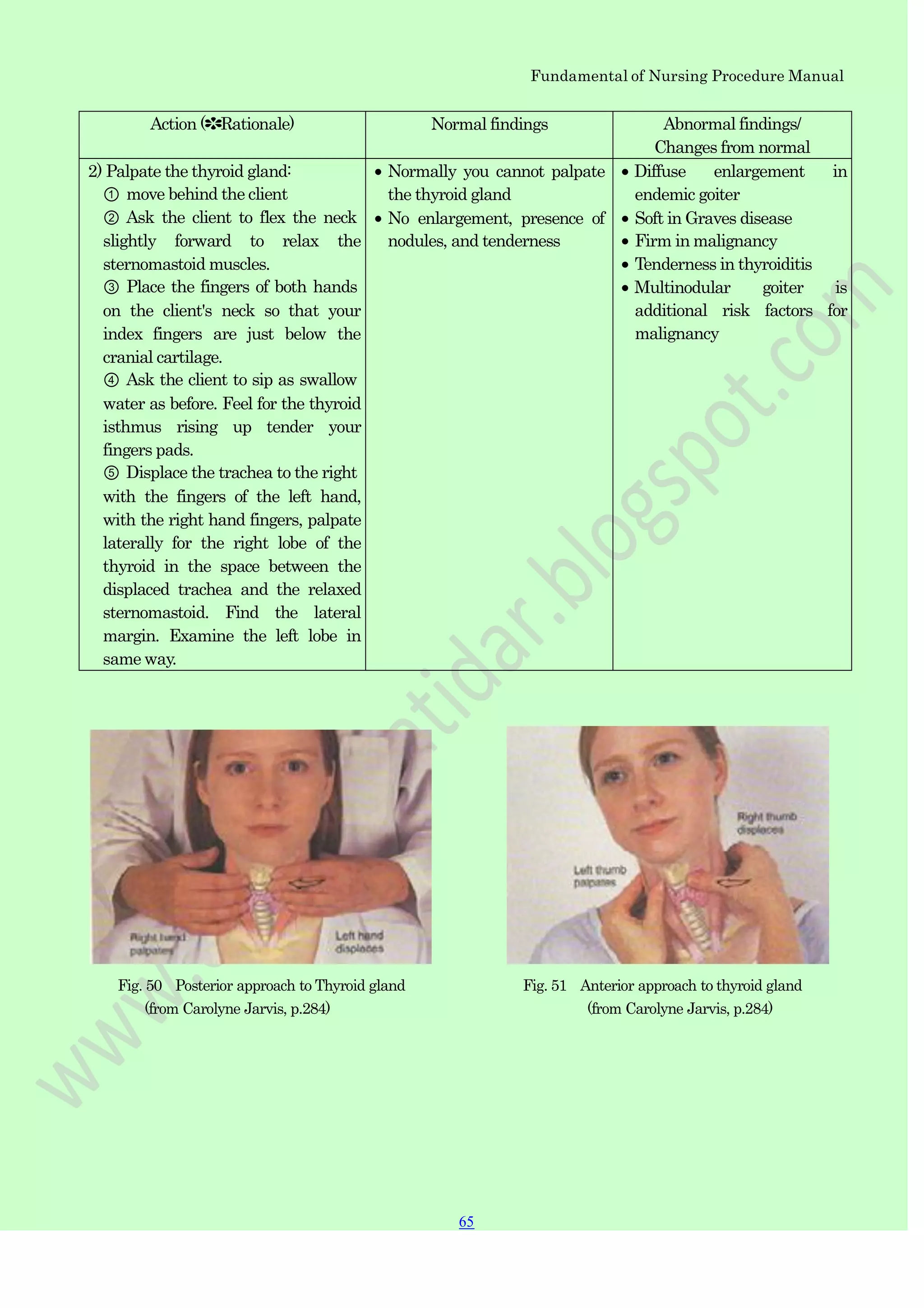 Fundamental of Nursing Procedure Manual
Action (✽Rationale) Normal findings Abnormal findings/
Changes from normal
2) Palpate the thyroid gland:
① move behind the client
② Ask the client to flex the neck
slightly forward to relax the
sternomastoid muscles.
③ Place the fingers of both hands
on the client's neck so that your
index fingers are just below the
cranial cartilage.
④ Ask the client to sip as swallow
water as before. Feel for the thyroid
isthmus rising up tender your
fingers pads.
⑤ Displace the trachea to the right
with the fingers of the left hand,
with the right hand fingers, palpate
laterally for the right lobe of the
thyroid in the space between the
displaced trachea and the relaxed
sternomastoid. Find the lateral
margin. Examine the left lobe in
same way.
Normally you cannot palpate
the thyroid gland
No enlargement, presence of
nodules, and tenderness
Diffuse enlargement in
endemic goiter
Soft in Graves disease
Firm in malignancy
Tenderness in thyroiditis
Multinodular goiter is
additional risk factors for
malignancy
Fig. 50 Posterior approach to Thyroid gland Fig. 51 Anterior approach to thyroid gland
(from Carolyne Jarvis, p.284) (from Carolyne Jarvis, p.284)
65
 