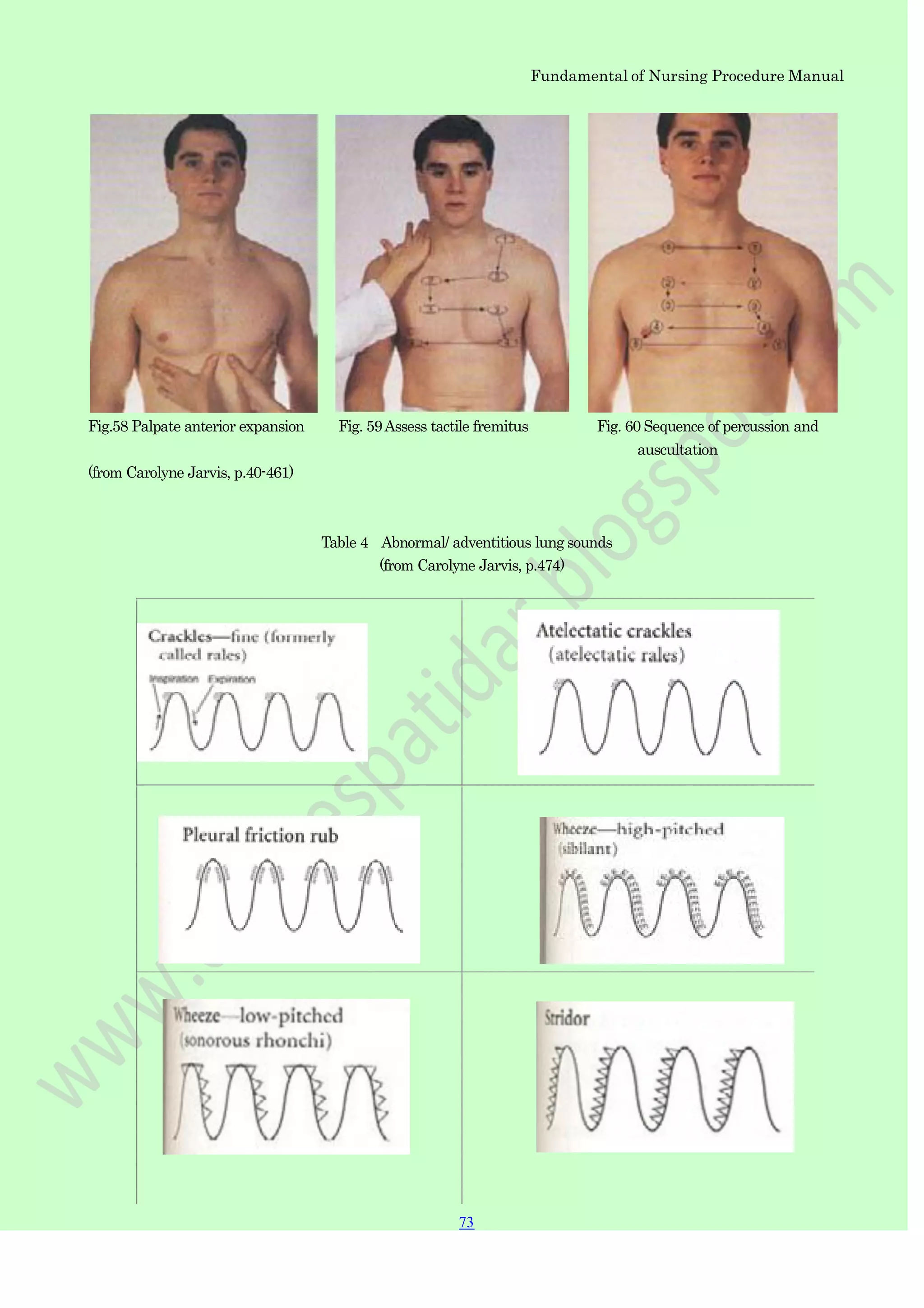 Fundamental of Nursing Procedure Manual
Fig.58 Palpate anterior expansion Fig. 59Assess tactile fremitus Fig. 60 Sequence of percussion and
auscultation
(from Carolyne Jarvis, p.40-461)
Table 4 Abnormal/ adventitious lung sounds
(from Carolyne Jarvis, p.474)
73
 