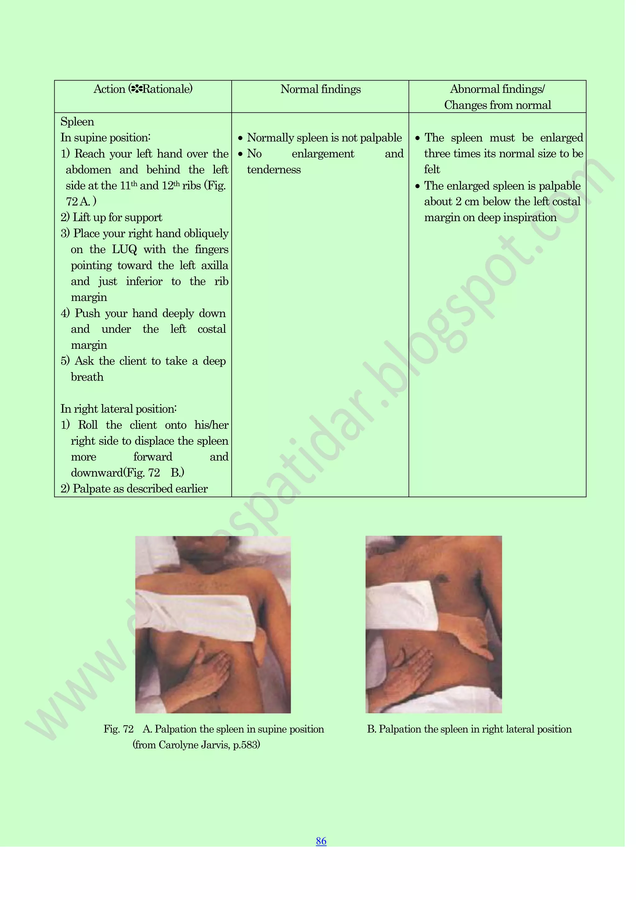 86
86
Action (✽Rationale) Normal findings Abnormal findings/
Changes from normal
Spleen
In supine position:
1) Reach your left hand over the
abdomen and behind the left
side at the 11th and 12th ribs (Fig.
72A. )
2) Lift up for support
3) Place your right hand obliquely
on the LUQ with the fingers
pointing toward the left axilla
and just inferior to the rib
margin
4) Push your hand deeply down
and under the left costal
margin
5) Ask the client to take a deep
breath
In right lateral position:
1) Roll the client onto his/her
right side to displace the spleen
more forward and
downward(Fig. 72 B.)
2) Palpate as described earlier
Normally spleen is not palpable
No enlargement and
tenderness
The spleen must be enlarged
three times its normal size to be
felt
The enlarged spleen is palpable
about 2 cm below the left costal
margin on deep inspiration
Fig. 72 A. Palpation the spleen in supine position B. Palpation the spleen in right lateral position
(from Carolyne Jarvis, p.583)
 