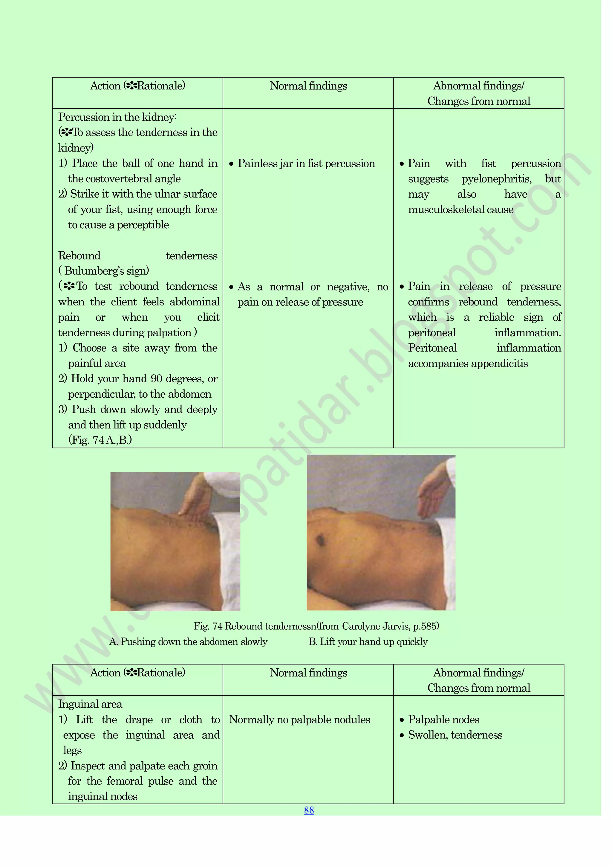 88
88
Action (✽Rationale) Normal findings Abnormal findings/
Changes from normal
Percussion in the kidney:
(✽To assess the tenderness in the
kidney)
1) Place the ball of one hand in
the costovertebral angle
2) Strike it with the ulnar surface
of your fist, using enough force
to cause a perceptible
Rebound tenderness
( Bulumberg‟s sign)
(✽To test rebound tenderness
when the client feels abdominal
pain or when you elicit
tenderness during palpation )
1) Choose a site away from the
painful area
2) Hold your hand 90 degrees, or
perpendicular, to the abdomen
3) Push down slowly and deeply
and then lift up suddenly
(Fig. 74A.,B.)
Painless jar in fist percussion
As a normal or negative, no
pain on release of pressure
Pain with fist percussion
suggests pyelonephritis, but
may also have a
musculoskeletal cause
Pain in release of pressure
confirms rebound tenderness,
which is a reliable sign of
peritoneal inflammation.
Peritoneal inflammation
accompanies appendicitis
Fig. 74 Rebound tendernessn(from Carolyne Jarvis, p.585)
A. Pushing down the abdomen slowly B. Lift your hand up quickly
Action (✽Rationale) Normal findings Abnormal findings/
Changes from normal
Inguinal area
1) Lift the drape or cloth to
expose the inguinal area and
legs
2) Inspect and palpate each groin
for the femoral pulse and the
inguinal nodes
Normally no palpable nodules Palpable nodes
Swollen, tenderness
 