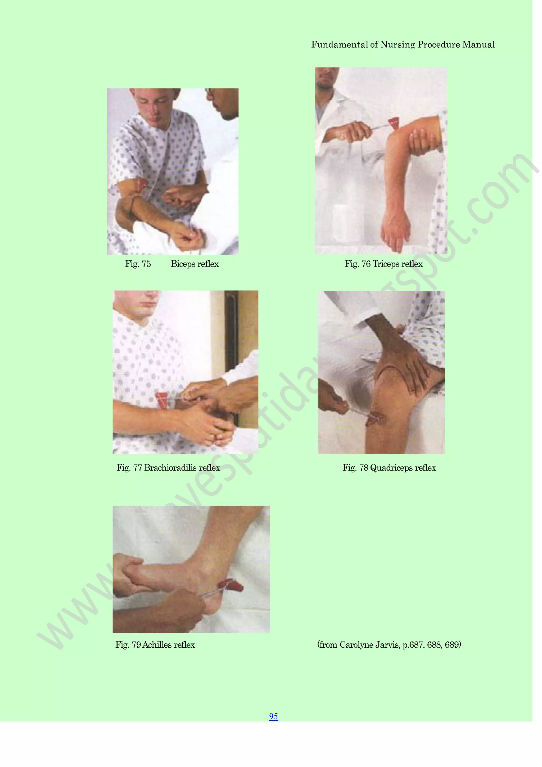 Fundamental of Nursing Procedure Manual
Fig. 75 Biceps reflex Fig. 76 Triceps reflex
Fig. 77 Brachioradilis reflex Fig. 78 Quadriceps reflex
Fig. 79Achilles reflex (from Carolyne Jarvis, p.687, 688, 689)
95
 