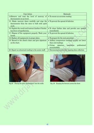 42
42
CareAction Rationale
14.Remove and read the level of mercury of
thermometer at eye level.
To ensure an accurate reading
15. Shake mercury down carefully and wipe the
thermometer from the stem to bulb with spirit
swab.
To prevent the spread of infection
16. Explain the result and instruct him/her if he/she
has fever or hypothermia.
To share his/her data and provide care needed
immediately
17. Dispose of the equipment properly. Wash your
hands.
To prevent the spread of infection
18. Replace all equipments in proper place. To prepare for the next procedure
19. Record in the client‟s chart and give signature
on the chart.
Axillary temperature readings usually are lower
than oral readings.
Giving signature maintains professional
accountability
20. Report an abnormal reading to the senior staff. Documentation provides ongoing data collection
Fig.28 Placing the glass thermometer into the axilla Fig. 29 Keeping the forearm across the chest
 