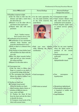 Fundamental of Nursing Procedure Manual
Action (✽Rationale) Normal findings Abnormal findings/
Changes from normal
8) Pupillary response to light
①Ask the client to look into the
distance and light a torch from
the side of the eye
②Remove it on the other side to
and observe how pupil reacts
③ Repeat other side with same
procedure
Fig.45 Papillary response
(from Carolyne Jarvis, p.703)
9)Coordination of eye movements
(✽Coordination of eye movements
indicates brain function and
muscular attachments to eyes.)
①Hold as object at a distance from
the client
②Ask him/her to keep his/her head
still and follow the object with the
eyes only
③Move the object towards his/her
right and left eye ,then towards
the ceiling and floor.
④Repeat it on the other side to
10) Convergence test
①Ask the client to follow your
finger or a pencil as you move it
in toward the bridge of the nose.
② The converging eyes normally
follows the object to within 5 cm
to 8 cm of the eyes
11) Snellen eye chart test
(✽ To check visual acuity)
①Use the Snellen eye chart,
which includes objects, letters, or
numbers of different sizes in
rows, under well-light
② Position the client 20 feet
from the chart and ask the client
to identify the items.
③ Compares visual acuity of the
client with normal vision
As the torch approaches the
eye, the pupil constricts. And
as the torch removed, the
pupil dilates.
Both eyes move together
while following the objects:
coordination
Good convergence
20/20 vision as normal
Unresponsive to light
Pupil remains dilated even
after torch removed due to
oculomotior nerve paralysis.
Small irregular pupils seen
as central nervous system
syphilis.
Eyes do not move together
when the object moves in
paralysis of the cranial
nerve.
Strabismus(cross-eyed or
wall-eyed)
Client reports
diplopia(double-vision)
Poor convergence in
hypothyroism
Myopia(near-sightedness)
Hyperopia(far-sightedness)
is impaired in middle and
elder people.
Legal blindness
58
 