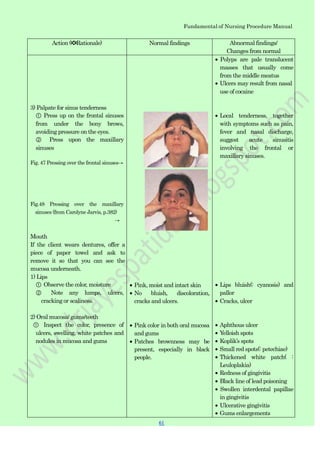 Fundamental of Nursing Procedure Manual
Action (✽Rationale) Normal findings Abnormal findings/
Changes from normal
3) Palpate for sinus tenderness
① Press up on the frontal sinuses
from under the bony brows,
avoiding pressure on the eyes.
② Press upon the maxillary
sinuses
Fig. 47 Pressing over the frontal sinuses→
Fig.48 Pressing over the maxillary
sinuses (from Carolyne Jarvis, p.382)
→
Mouth
If the client wears dentures, offer a
piece of paper towel and ask to
remove it so that you can see the
mucosa underneath.
1) Lips
① Observe the color, moisture
② Note any lumps, ulcers,
cracking or scaliness.
2) Oral mucosa/ gums/teeth
① Inspect the color, presence of
ulcers, swelling, white patches and
nodules in mucosa and gums
Pink, moist and intact skin
No bluish, discoloration,
cracks and ulcers.
Pink color in both oral mucosa
and gums
Patches brownness may be
present, especially in black
people.
Polyps are pale translucent
masses that usually come
from the middle meatus
Ulcers may result from nasal
use of cocaine
Local tenderness, together
with symptoms such as pain,
fever and nasal discharge,
suggest acute sinusitis
involving the frontal or
maxillary sinuses.
Lips bluish(: cyanosis) and
pallor
Cracks, ulcer
Aphthous ulcer
Yelloish spots
Koplik‟s spots
Small red spots(: petechiae)
Thickened white patch( :
Leuloplakia)
Redness of gingivitis
Black line of lead poisoning
Swollen interdental papillae
in gingivitis
Ulcerative gingivitis
Gums enlargements
61
 