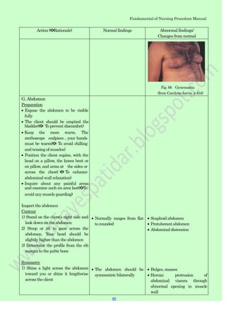Fundamental of Nursing Procedure Manual
Action (✽Rationale) Normal findings Abnormal findings/
Changes from normal
Fig. 66 Gynemastia
(from Carolyne Jarvis, p.434)
G. Abdomen
Preparation
Expose the abdomen to be visible
fully
The client should be emptied the
bladder(✽ To prevent discomfort)
Keep the room warm. The
stethoscope endpiece , your hands
must be warm(✽ To avoid chilling
and tensing of muscles)
Position the client supine, with the
head on a pillow, the knees bent or
on pillow, and arms at the sides or
across the chest( ✽ To enhance
abdominal wall relaxation)
Inquire about any painful areas
and examine such an area last(✽To
avoid any muscle guarding)
Inspect the abdomen
Contour
1) Stand on the client‟s right side and
look down on the abdomen
2) Stoop or sit to gaze across the
abdomen. Your head should be
slightly higher than the abdomen
3) Determine the profile from the rib
margin to the pubic bone
Symmetry
1) Shine a light across the abdomen
toward you or shine it lengthwise
across the client
Normally ranges from flat
to rounded
The abdomen should be
symmentric bilaterally
Scaphoid abdomen
Protuberant abdomen
Abdominal distension
Bulges, masses
Hernia; protrusion of
abdominal viscera through
abnormal opening in muscle
wall
80
 