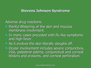 Stevens Johnson Syndrome Adverse drug reactions.  Painful Blistering of the skin and mucous membrane involvment.  In many cases preceded with flu like symptoms and high fever.  As it evolves the skin literally sloughs off.  Ocular involvement includes severe conjunctivis, iritis, palpebral edema, conjunctival and corneal blisters and erosions, and corneal perforation.  www.freelivedoctor.com 