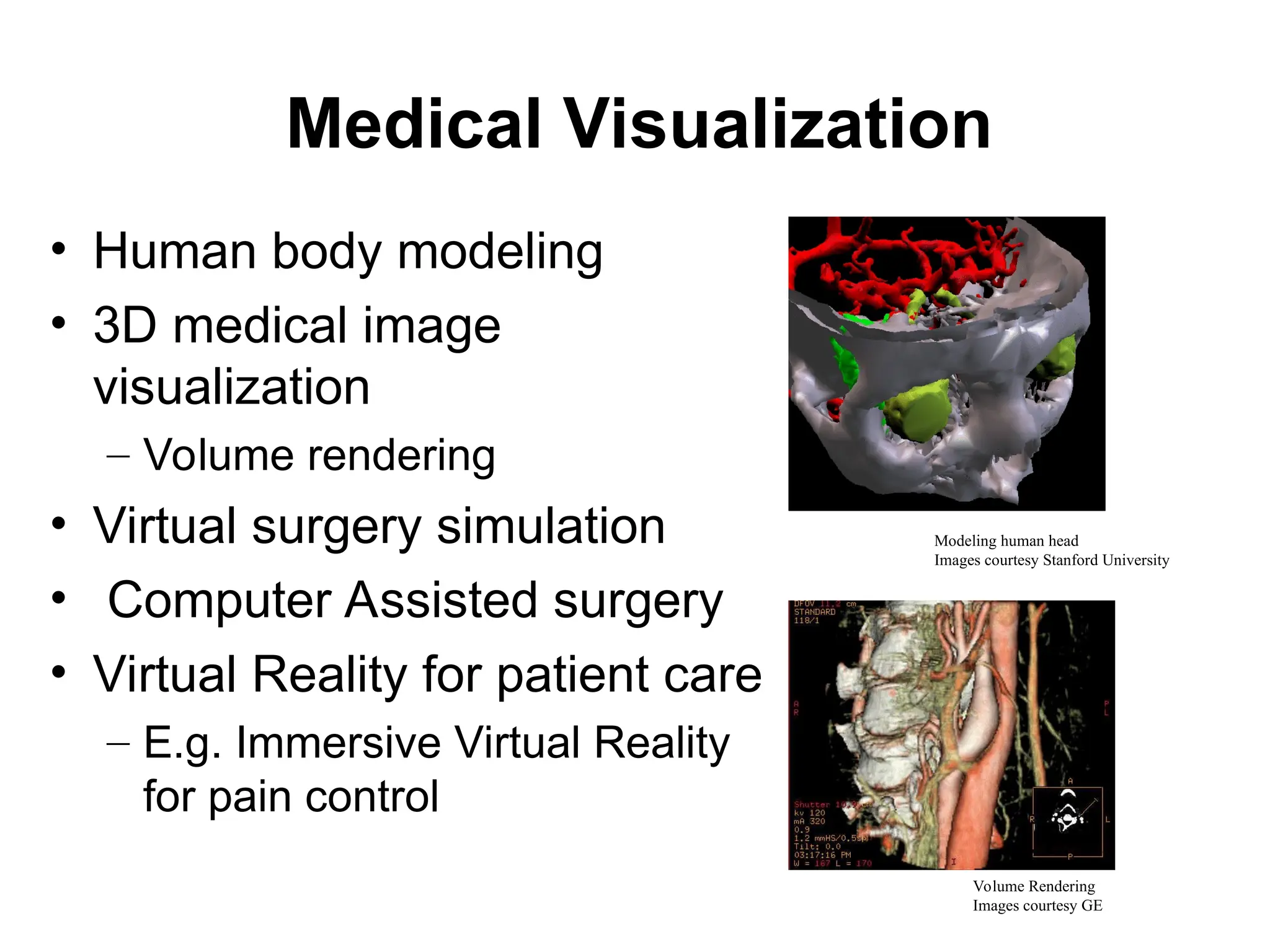 Medical Visualization
• Human body modeling
• 3D medical image
visualization
– Volume rendering
• Virtual surgery simulation
• Computer Assisted surgery
• Virtual Reality for patient care
– E.g. Immersive Virtual Reality
for pain control
Volume Rendering
Images courtesy GE
Modeling human head
Images courtesy Stanford University
 