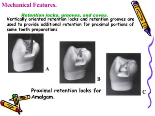 Fundamentals of tooth preparation - operative dentistry | PPT
