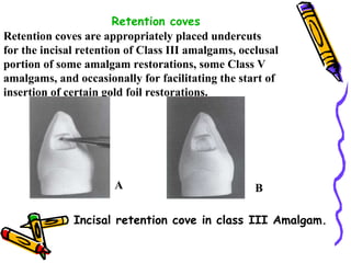 Fundamentals of tooth preparation - operative dentistry | PPT