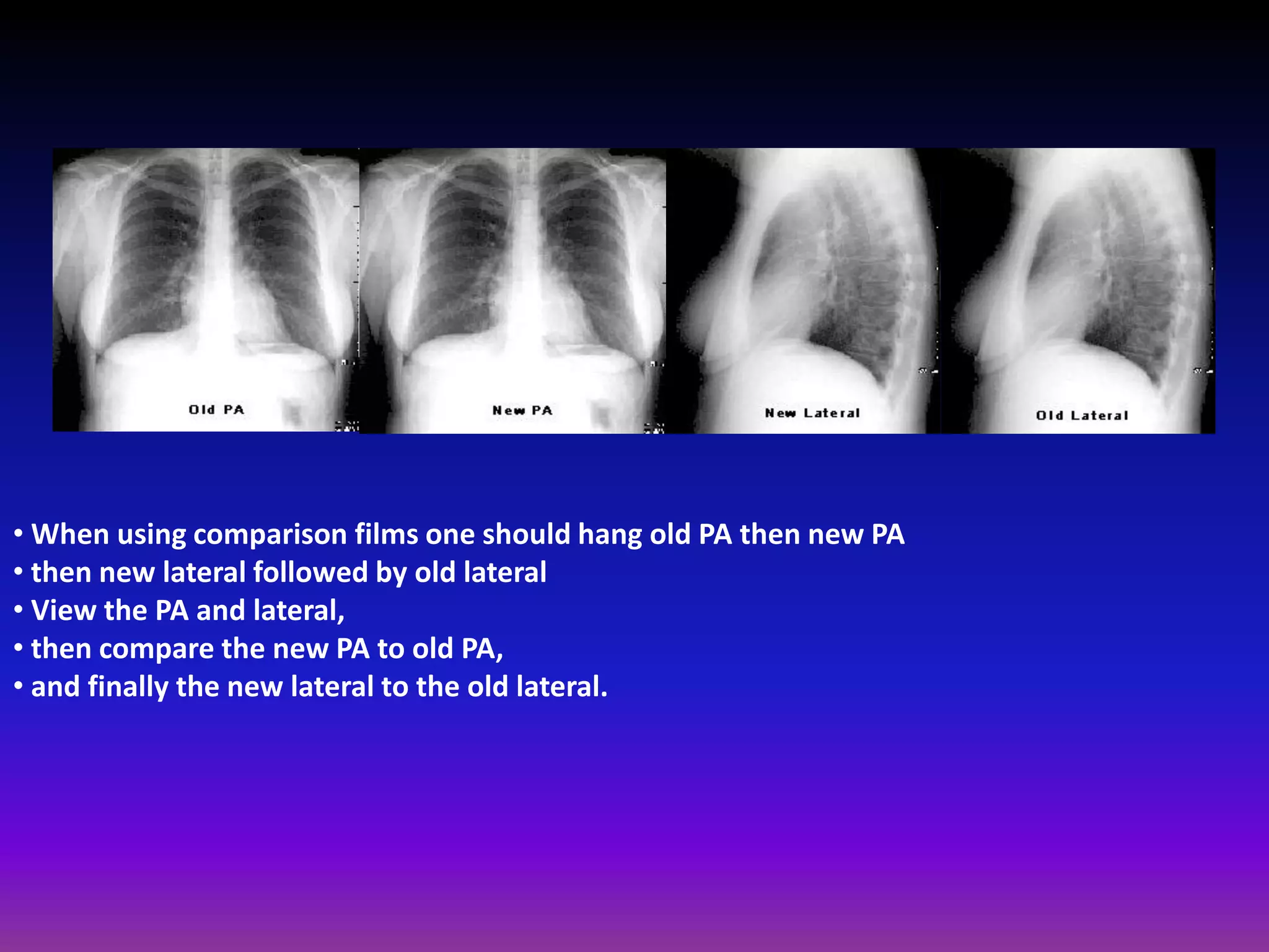 Fundamentals of chest radiology | PDF