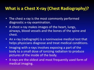 Fundamentals of chest radiology | PDF