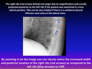 Fundamentals of chest radiology | PDF