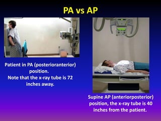 Ap Position Radiology Fundamentals of chest radiology | PDF