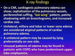 Fundamentals of chest radiology | PDF