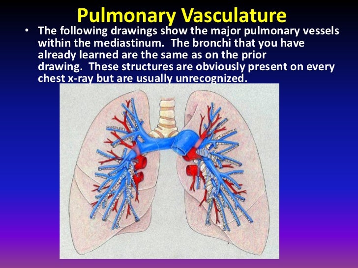 Fundamentals of chest radiology